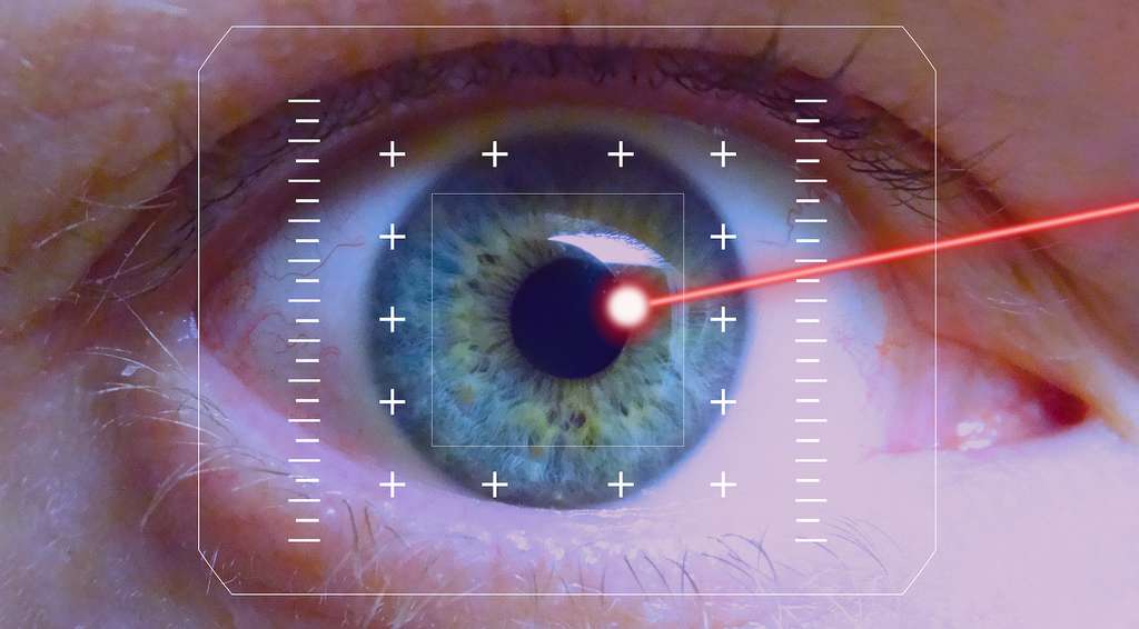 Les questions / réponses de l’optique concernant l’opération des yeux au laser